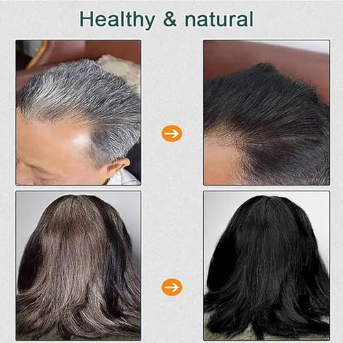 Vivping Zhihuashi Caviar Protein Hair Dye, Qiweitang Hair Dye Shampoo, Plant-Based Hair Coloring Cream, Natural Plant Formula, Caviar Color Cream for Women & Men (Black)