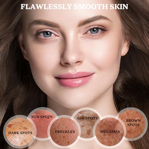 Dark Spot Remover for Face and Body: Dark Spot Corrector Cream, Melasma, Freckle, Sun Spot, Age Spot Remover with Niacinamide and Vitamin C, Advanced Formula for Women and Men (1.7 Fl Oz)