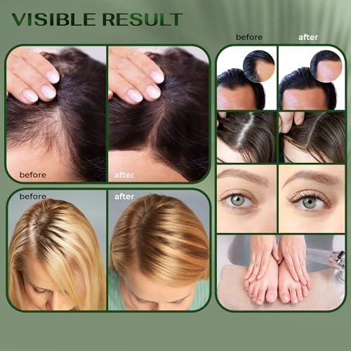 Batana & Rosemary Oil for Hair Growth - 100% Pure Organic Blend (4 FL OZ) - with Scalp Massager & Applicator - Dr. Sebi Inspired Formula - For Men & Women