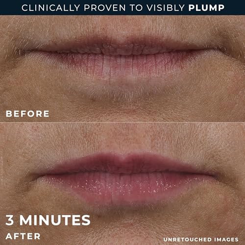 RoC Derm Correxion Lip Volumizer - Lip Plumper Peptide Treatment with Hyaluronic Acid & Vitamin E + Line Smoothing Eye Cream Packette
