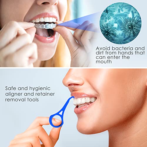 ARGOMAX - Aligner Removal Tool, 100 Retainer Remover Tool, Invisible Braces Removal Tools, Suitable for Removing Braces, Trays, Retainers, Dentures and Aligners(Blue).