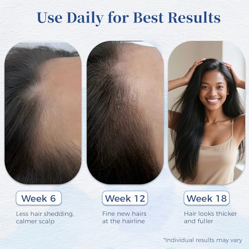 Hair Growth Serum Roll On 25ml/0.84Oz with Saw Palmetto, Rosemary & Pea Extract£¬Helps Support Thicker, Fuller Hair Appearance, Non-Greasy Hair Loss Support for Men & Women (2pcs)