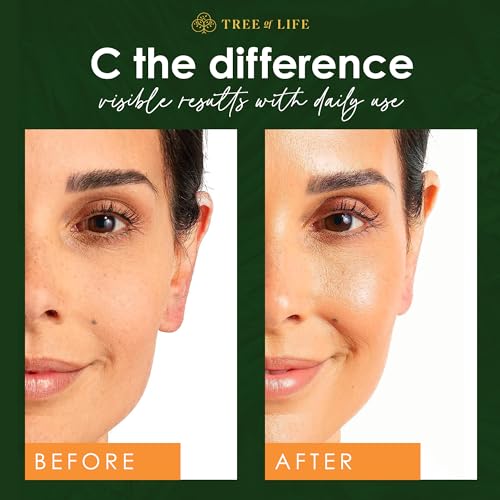 Tree of Life Beauty Vitamin C Skin Care Set, Skin Face Oil, Facial Serums for Dry and Sensitive Skin with Hyaluronic Acid & Vitamin E Soft Skin, 1 Fl Oz (Pack of 2)