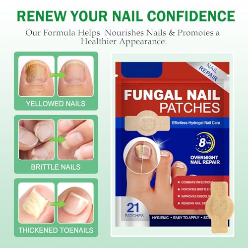 Fungal Nail Patches & Ginger 7 Days Nail Treatment, 21pcs Toenail Treatment Patches Extra Strength - Overnight Nails Repair Care for Damaged, Discolored Nails