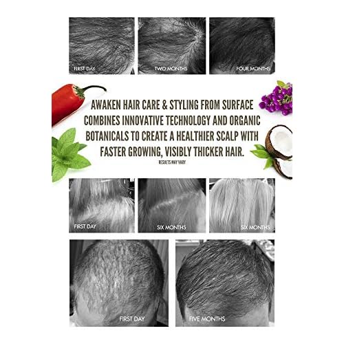 Surface Hair - Awaken Therapeutic Conditioner ? Natural Ingredients for Thinning Hair and a Healthy Scalp