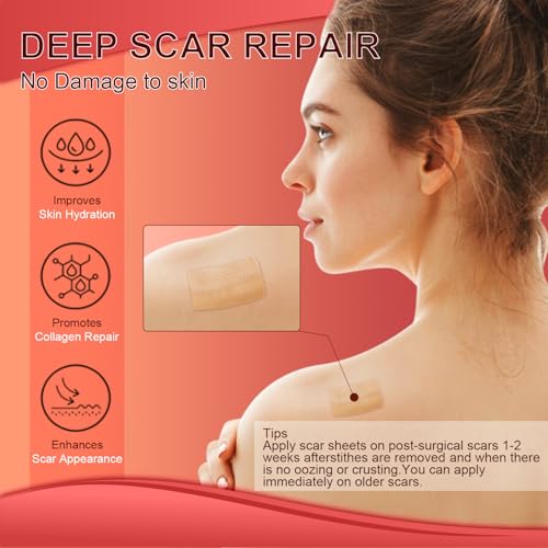 Silicone Scar Sheets (1.6¡±x 60¡± Roll-1.5M), Medical Grade Silicone Scar Tape Roll, Reusable Silicone Scar Strip, Professional Scar Removal Sheets for Surgery, C-Section, Burn, Keloid, Acne Etc