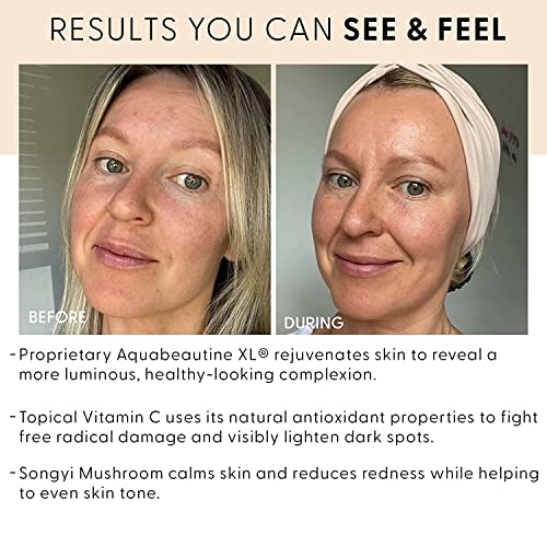 NAVA MD Spot Correcting Serum | Highly Concentrated Solution | Developed by Doctors and Scientists | Target Dark Spots and other Signs of Aging | Contains Aquabeautine XL