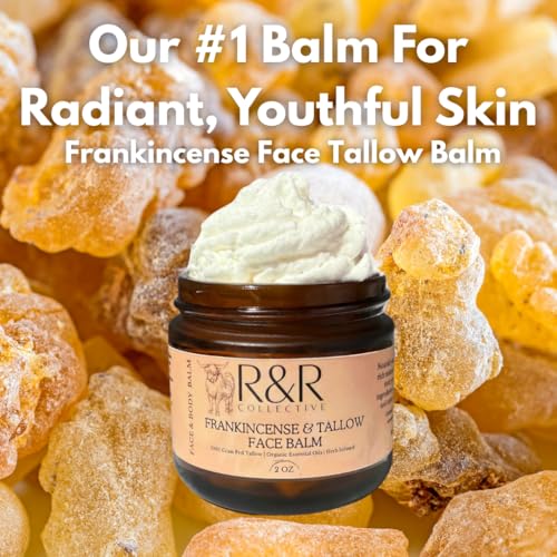 Frankincense Tallow Face Moisturizer ? 100% Grass-Fed Whipped Beef Tallow Balm for Dry, Sensitive Skin, Eczema & Psoriasis ? Handmade Natural Skincare ? 2 oz