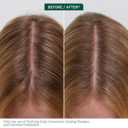 Biolage Scalp Sync Purifying Concentrate - Exfoliating & Clarifying Dry Scalp Treatment, Refreshing & Reinvigorating, Fermented Tea Blend & Glycolic Acid