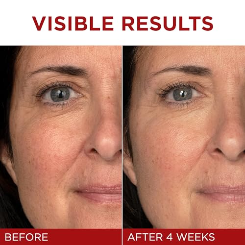 L'Oreal Paris Revitalift Triple Power Anti-Aging Face Moisturizer, Pro Retinol, Hyaluronic Acid & Vitamin C, Reduce Wrinkles 2.55 Oz