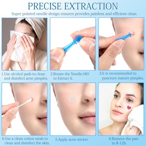 Sterile Needles for Pimples, 50 Pcs Disposable Sterile Pimple Needle and 72 Dots Acne Stickers, Pimple Popper Needle for Clear Skin, Acne Needles Tool for Milia Remover