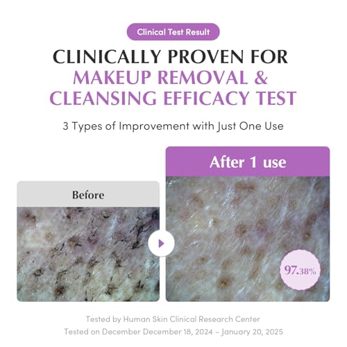 EQQUALBERRY Purple Rice Pore Smoothing Cleansing Oil ? Deep Cleansing for Pores & Blackheads | Korean Oil Cleanser for Face & Makeup Remover | Hydrating & Soothing Formula, 6.76 fl.oz