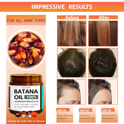 AZURE Batana Oil Paste for Hair Growth, 100% Pure Batana Paste for Nourishing Scalp, Strengthening Strands, Enhancing Shine & Softness - Honduras Sourced - For All Hair Types 4 Fl Oz (Pack of 1)