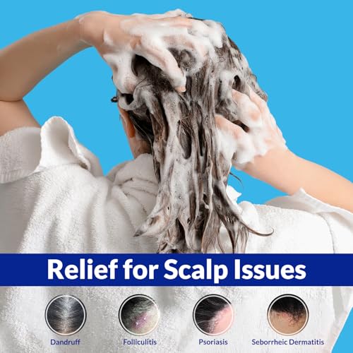Psoriasis Shampoo, Seborrheic Dermatitis Folliculitis Shampoo, Anti-Fungal and Anti-Dandruff for Men and Women 300ML.