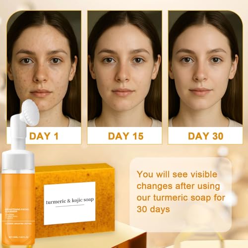 Turmeric Soap & Turmeric Face Wash Set, Honey Lemon Tumeric Kojic Soap Bar & Facial Cleanser Combo for Face & Body, Evens Skin Tone Deep Cleansing Moisturizing