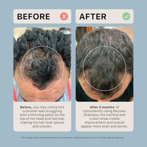 ACTIIV Ultimate Power Trio For Men | Promotes Fuller Hair And Beard, Strengthens And Hydrates, Includes Shampoo, Conditioner & Beard Oil, Vegan, Color-Safe, For All Hair And Beard Types