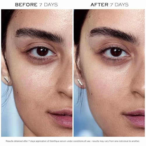 Lanc?me Advanced G?nifique Radiance Boosting Anti-Aging Face Serum - Visibly Hydrates & Plumps Skin - with Bifidus Prebiotic, Hyaluronic Acid & Vitamin Cg
