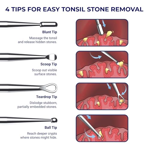 Oravix Tonsil Stone Remover Tool Pack of 2, Metal Tonsil Stone Removal Tool, 7¡¯¡¯ Surgical-Grade Stainless Steel Metal Pick with 10 Soft Silicone Tips, Fight Bad Breath, Safe & Easy