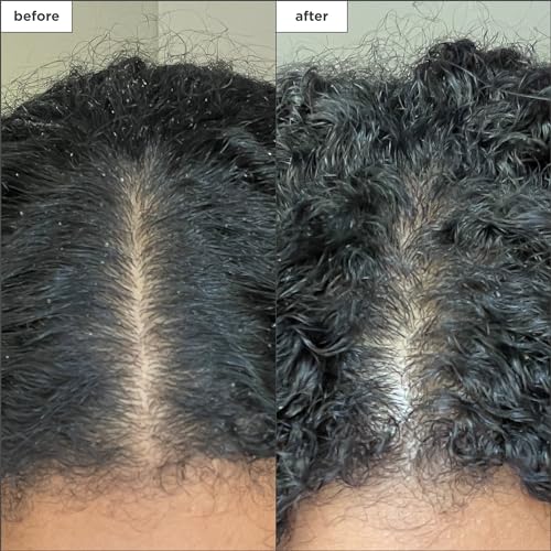 Briogeo Scalp Revival Charcoal + Coconut Oil Micro-Exfoliating Shampoo, Treatment for Dry & Itchy Scalp, Clarifying Shampoo for Build Up, Scalp Scrub for Oily Scalp, Vegan, Cruelty-Free