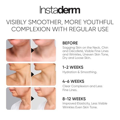 Neck and D?collet? Firming Cream ? Tightening & Lifting Treatment for Crepey, Wrinkles, sagging Skin & Vertical Lines. Anti-Aging Peptide Formula to Boost Hydration & Collagen in the Skin.