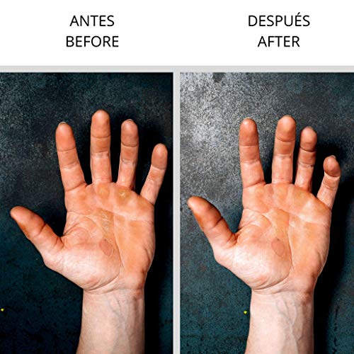 Velites Strong Sand Paper Spare Part for Callus Remover and Skin Care System for Athletes. Hand and Feet Callus Remover for Crossfit, Gymnastics, Climbing, and Running | Stone Skin Care System