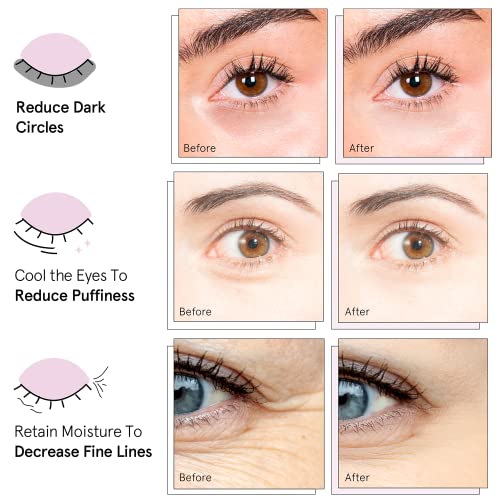 grace & stella Award Winning Under Eye Mask - Travel Essentials - Birthday Gifts for Women - Gel Eye Patches for Dark Circles, Puffy Eyes, Wrinkles, Undereye Bags - Vegan - Self Care (24 Pairs, Gold)
