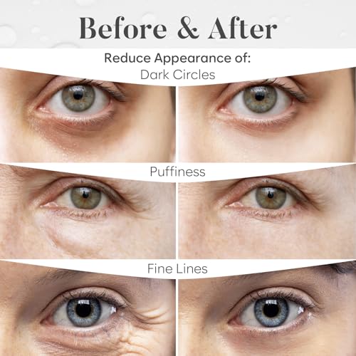 Variety Under Eye Patches (30 Pairs) - Dark Circles & Puffy Eyes Care - Eye Care Mask for Refreshment - 5 Varieties