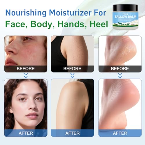 4-Pack Organic Grass-Fed Beef Tallow & Honey Balm for Face & Body | Sensitive Skin Face Moisturizer for Kids & Adults | Raw Wild Honey, Non-Greasy Eczema-Safe Formula (8oz) - Deep Hydration