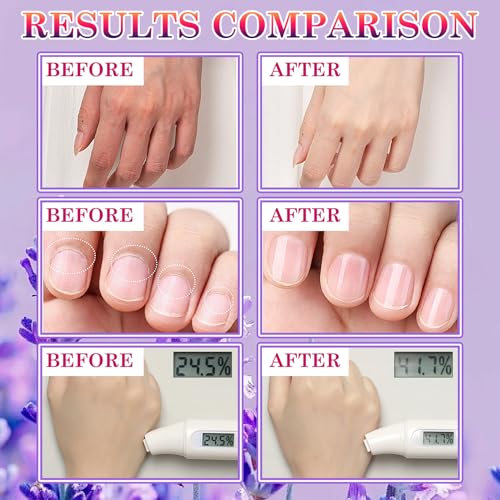 6 Pairs Hand Masks Moisturizing Gloves, Hydrating Hand Mask Moisturizer Gloves Care for Dry Cracked Hands, Smooth Long Lasting Soft Firming Hand Mask Gift Set for Men Women£¨A