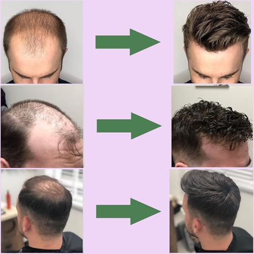 Men¡¯s Toupee 100% Human Hair French Lace Center PU Around Hair Replacement System for Men Natural Hairline 10x8Inches 6 Inch Hair Medium Density #7 Light Brown Color