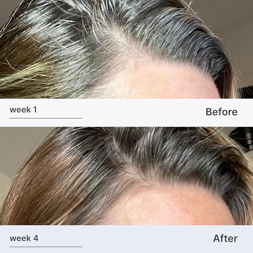 Better Not Younger Hair Thickening Serum for Women Over 40 ? Scalp Care, Hair Density Treatment and Anti-Aging 2fl.oz ? Fortifying Serum with Biotin & Ginger. Promotes Stronger, Thicker-Looking Hair.