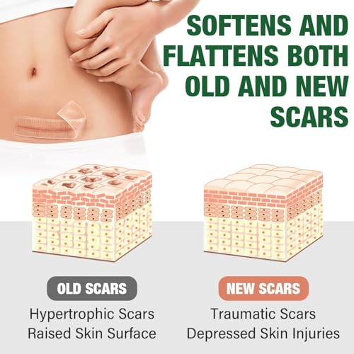 Silicone Scar Sheets,Silicone Scar Tape,Silicone Sheets For Scars,Scar Tape For Surgical Scars,Keloid Bump Removal,Scar Removal For Surgical(1.6"x 120" Roll-3M)