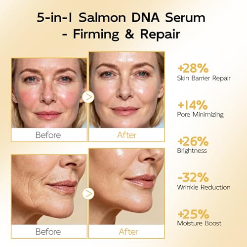YouthVibe 0.5% PDRN Serum for Face, Anti-Aging Salmon PDRN Facial Serums with Squalane,Hyaluronic Acid, Niacinamide, Hydrating & Moisturizing & Firming Skincare, Salmon DNA Face Serum - 30ml