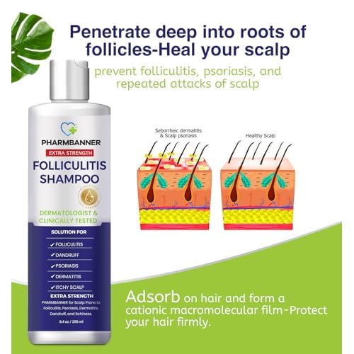 Anti-Fungal Shampoo for Folliculitis, Seborrheic Dermatitis, Scalp Psoriasis - Relieves Itchy & Dry Scalp