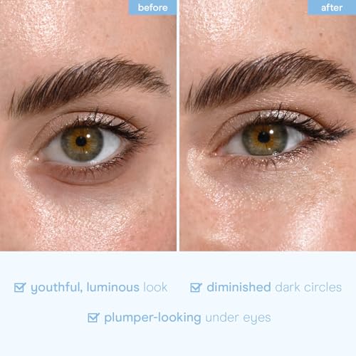 Baebody Advanced Snail Mucin Under Eye Patches for Women & Men (6 Pairs) - Under Eye Masks for Dark Circles and Puffiness - With Niacinamide - Reduce Fine Lines and Wrinkles