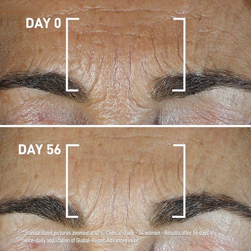 Filorga Global-Repair Advanced Elixir, Anti-Aging Face Treatment Repairs the Skin Barrier with a Rejuvenating Formula of Ceramides, Precious Oils, & Rose Extract to Reduce Wrinkles, 1.01 fl oz