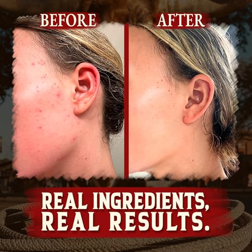 Organic Beef Tallow for Skin - 4 OZ (Unscented) ? Grass Fed Beef Tallow for face + Body ? US-Made Whipped Tallow and Honey Balm Moisturizer for Dry and Sensitive Skin, Eczema, Rosacea (No Additives)