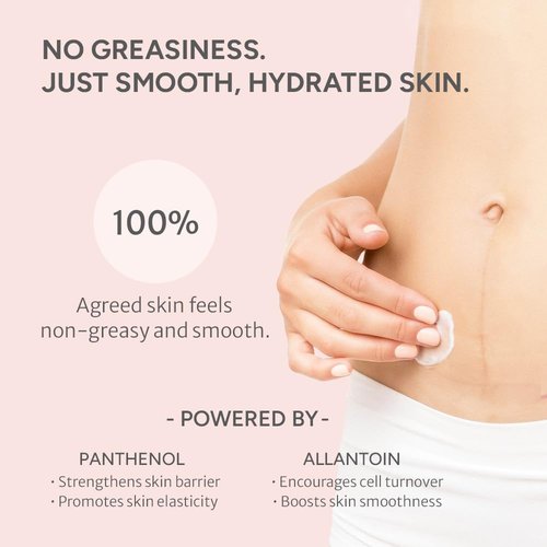 Noelo Hills Advanced Stretch Mark Cream for Pregnancy, Weight Gain, Growth Spurts - Pregnancy-Safe - Korean Skincare - Clinically Proven - Ultra Clean Ingredients - Fragrance Free - Vegan - 6.76 fl oz