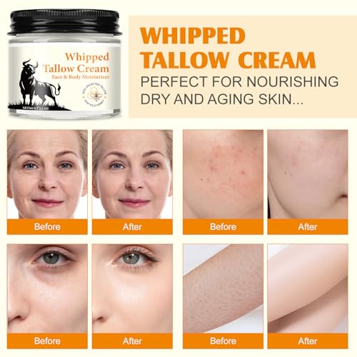 Beef Tallow Balm for Skin,Beef Tallow Balm for Sensitive Skin, Tallow Face Moisturizer with Grass-Fed Pure Beef Tallow & Honey & Beeswax for Dry Skin - 2.1 OZ