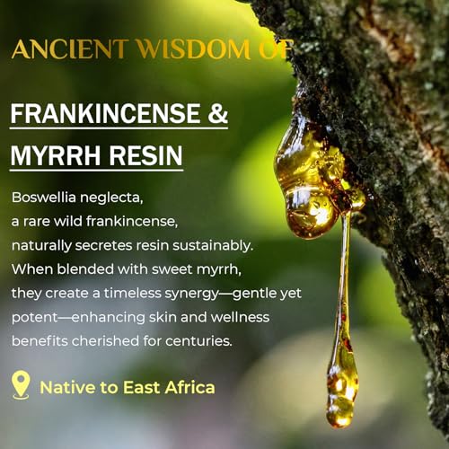 Frankincense Balm 4oz, Frankincense Essential Oil with Myrrh for Soothing Relief, Muscle Relaxation, Boswellia Serrata, Olive Oil, Vitamin E, Moisturizer for Dry, Cracked Skin