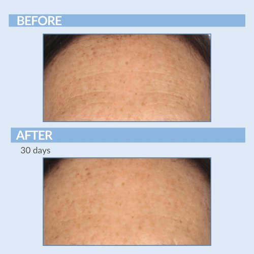Serious Skincare Retinol Cream For Face - Vitamin A Cream XR Premium Moisturizer - Anti-Aging - Day & Night - Reduce Fine Lines & Wrinkles - For Radiant Skin 2 Fl. Oz.
