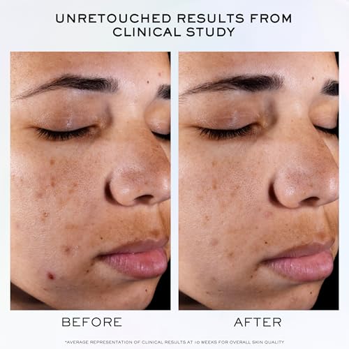 Lanc?me Clarifique Pro-Solution Face Serum - Facial Serum For Visibly Reducing Dark Spots & Acne Spots - With 10% PHA and Niacinamide