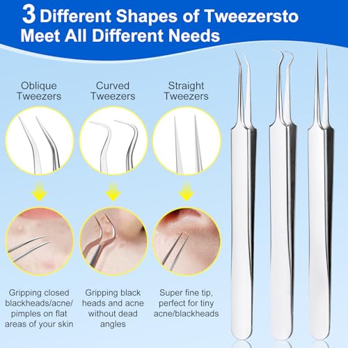 Pimple Popper Tool Kit,10 Pcs Professional Blackhead Remover Comedones Extractor for Easy Removal for Pimples,Blackheads,Zit Removing, Facial and Nose, Acne Removal Kit with Metal Box (Silver)