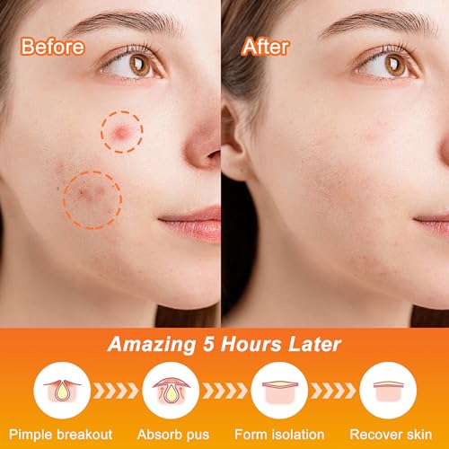 Pimple Patches,Halloween Acne Patch,Pimple Patches for Face, Cute Stickers,Salicylic Acid & Tea Tree, 100PCS Hydrocolloid Dots in 8 Colors for Face,Cute Halloween Stickers