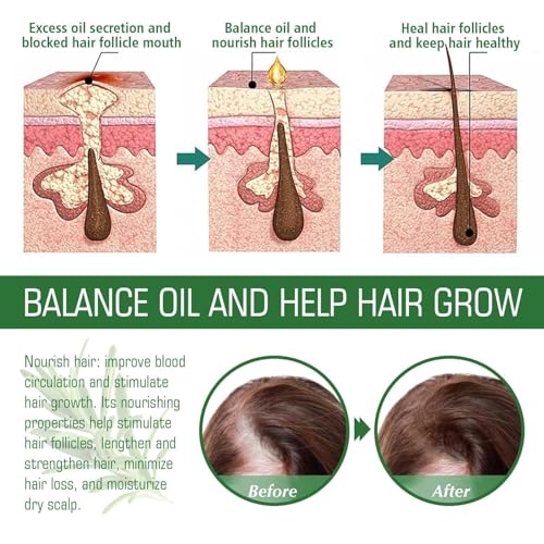 Aceite de Romero para Crecimiento y Tratamiento Capilar, Gotero para Estimular el Crecimiento del Cabello y Prevenir la Ca?da, 60ML/2.2 Fl Oz (2 Unidades)