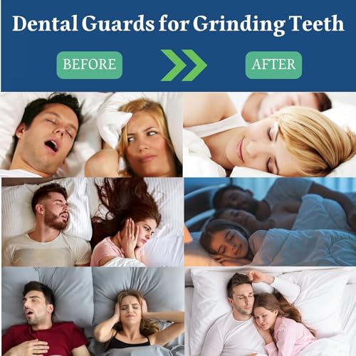 Mouth Guard for Clenching Teeth at Night, 4 Pcs Night Guards for Teeth Grinding, Professional Dental Guards for Grinding Teeth, Moldable Mouthguards for Grinding of Teeth, Teeth Grinding Guard