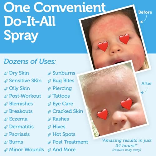 Happy Skin Hypochlorous Acid Spray for Face Travel Size ? Extra Strength Natural Full Body Cleansing Toner for Acne ? Soothe, Hydrate & Repair Dry, Sensitive Skin ? pH Balanced, Non-Toxic 2oz
