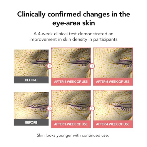 107% Smoother Crow¡¯s Feet & 104% Lifted Skin ? Boosts Elasticity & Moisture ? Firms & Restores Radiance with 10% Collagen Water & Hyaluronic Acid ? Korean Skincare Best Collagen Cream