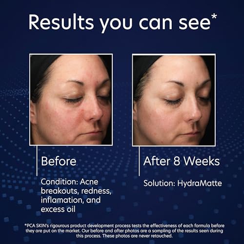 PCA SKIN HydraMatte Oil Control Moisturizer, Face Moisturizer for Oily Skin, Helps Reduce Oil and Promotes a Smoother Complexion, Absorbs Quickly, Great for Combination and Oily Skin, 1.8 oz Jar