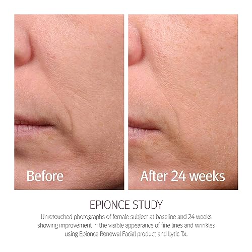 Epionce Renewal Facial Lotion - Hydrating, Anti-Aging Moisturizer for Normal to Combination Skin, For Fine Lines & Wrinkles, Dermatologist Skincare